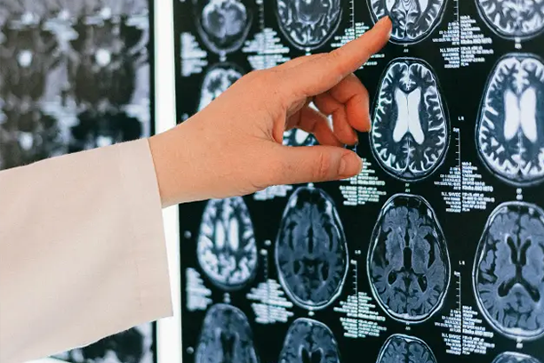 Brain Tumor Case Study