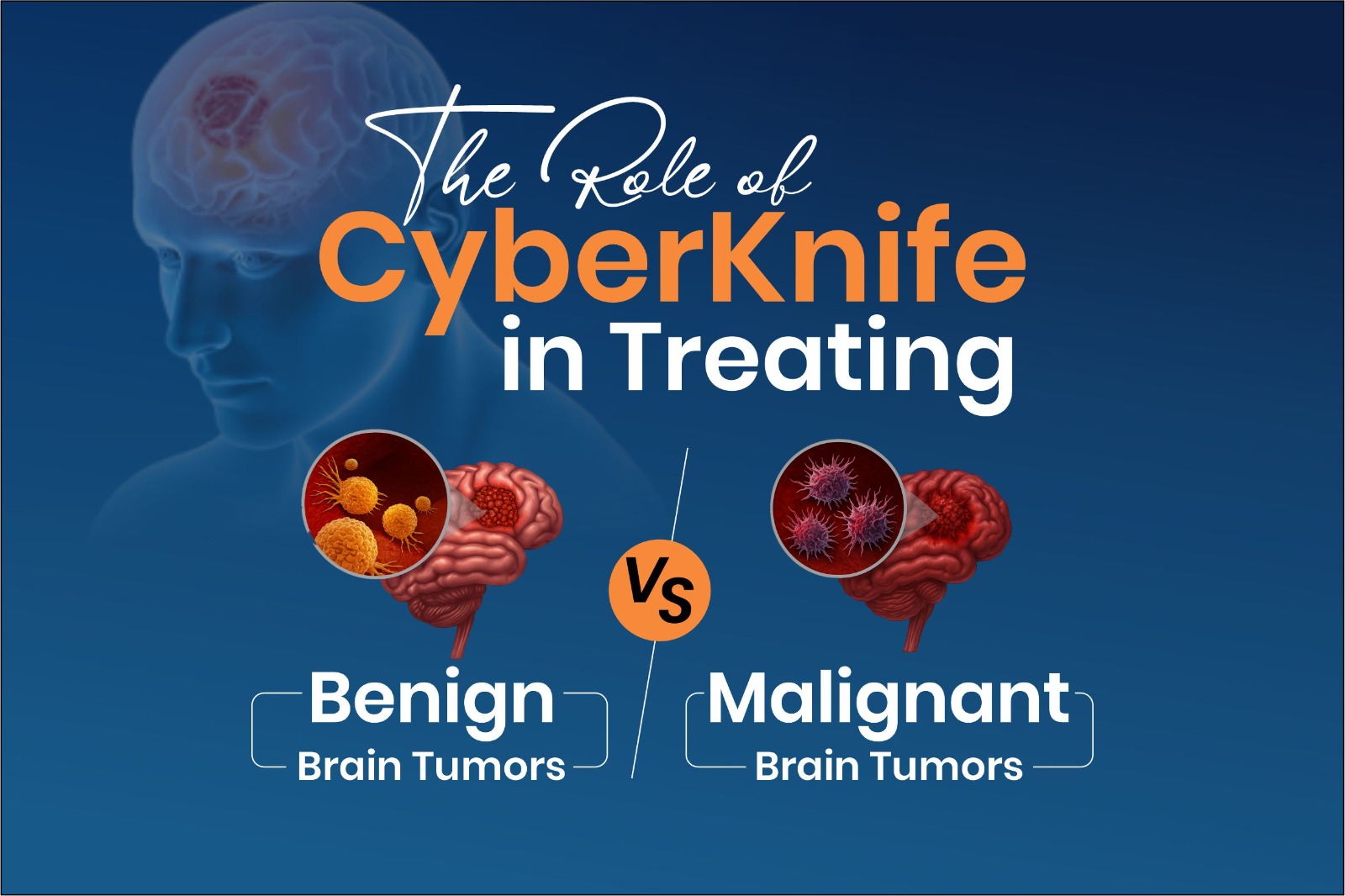 cyberknife surgery for brain tumor