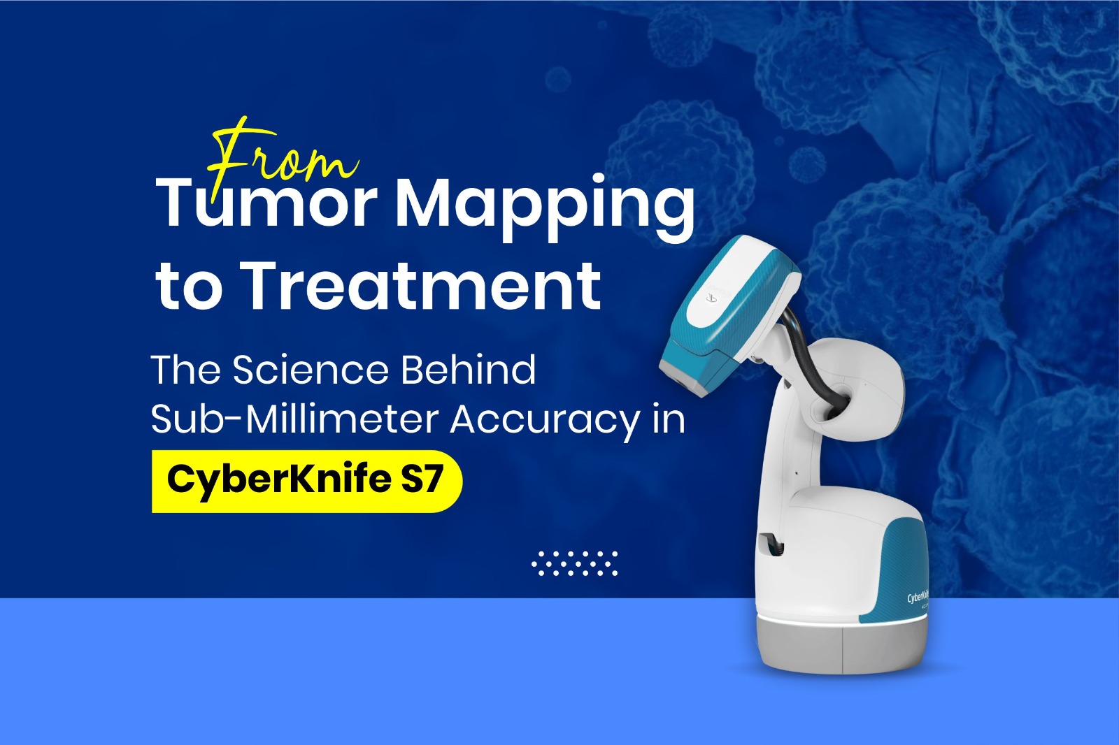 CyberKnife S7