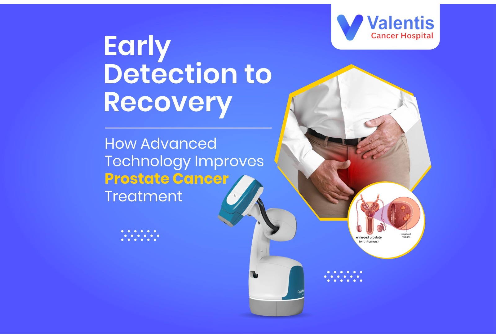 Prostate Cancer Treatment