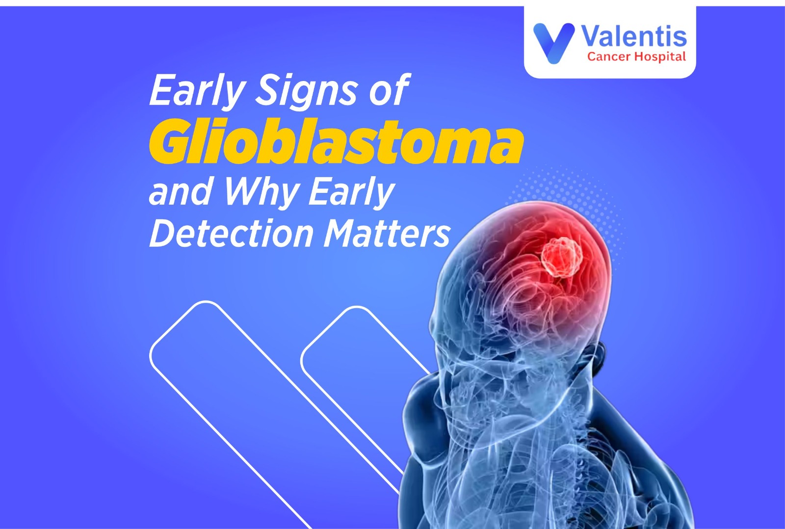 glioblastoma treatment in india