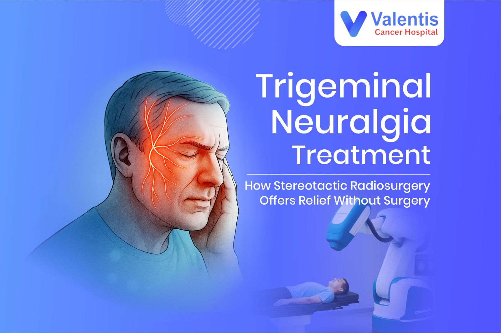 Trigeminal Neuralgia Treatment