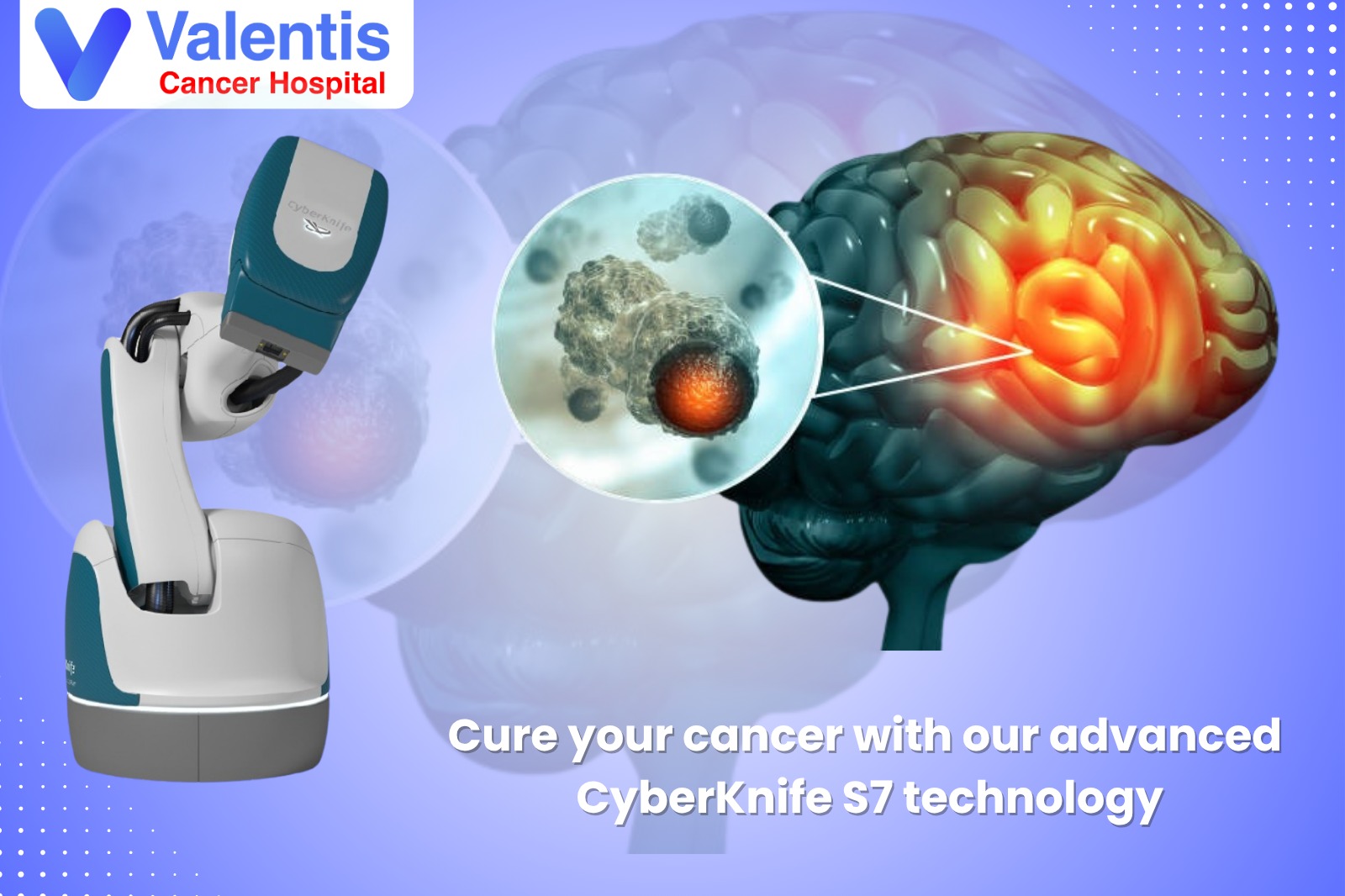 Brain Tumor Treatment in Meerut
