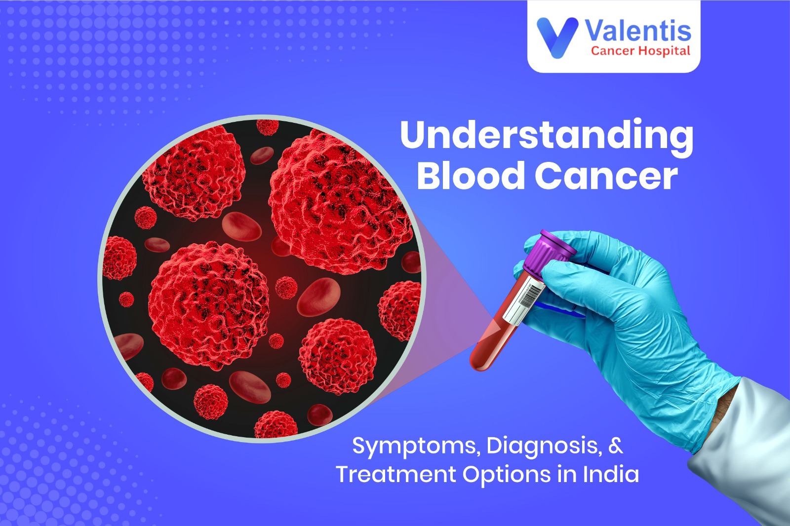 blood cancer treatment in india