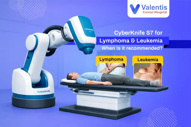 CyberKnife S7 for Lymphoma