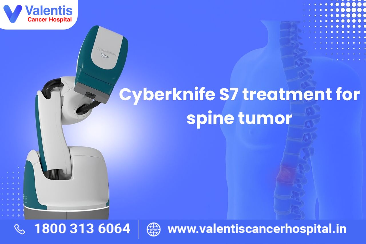 CyberKnife Treatment for Spine Tumor