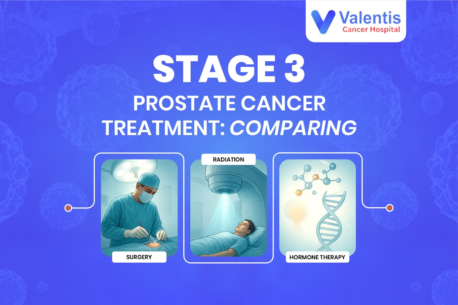 Stage 3 Prostate Cancer Treatment