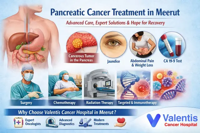 Pancreatic Cancer Treatment in Meerut
