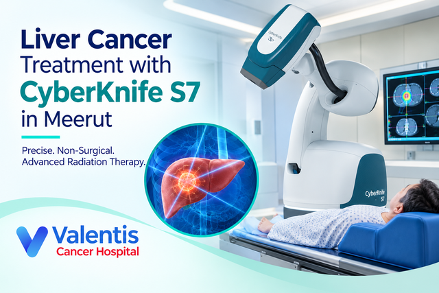 Liver Cancer Treatment with CyberKnife S7 in Meerut