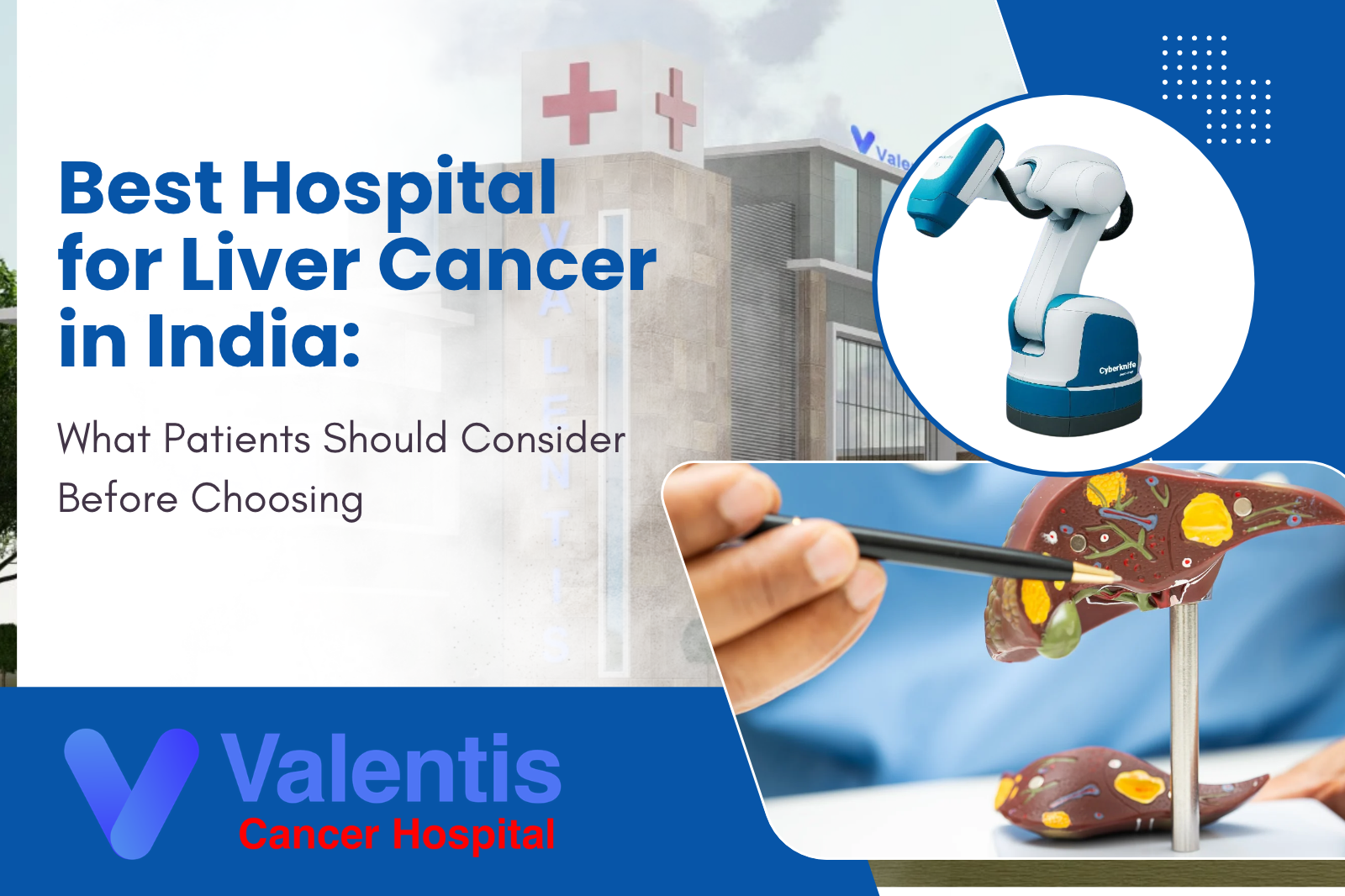 Best Hospital for Liver Cancer in India: What Patients Should Consider Before Choosing