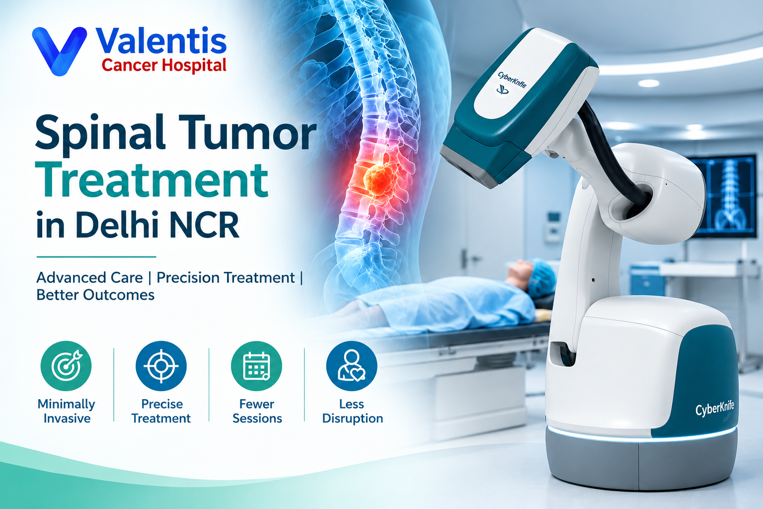Spine Tumor Treatment in Delhi NCR: Advanced Treatment Options and CyberKnife Technology